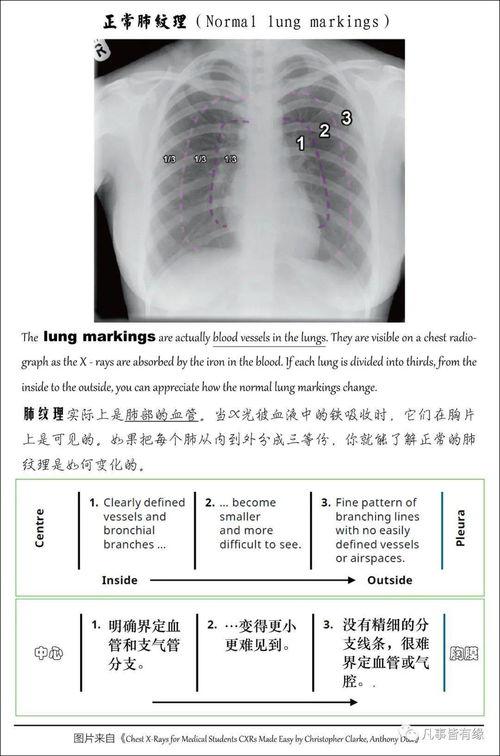 胸片爆料2023年最新版大揭秘,揭秘影像诊断新趋势